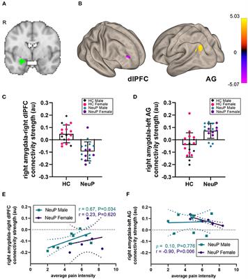Amygdalar Functional Connectivity Differences Associated With Reduced Pain Intensity in Pediatric Peripheral Neuropathic Pain